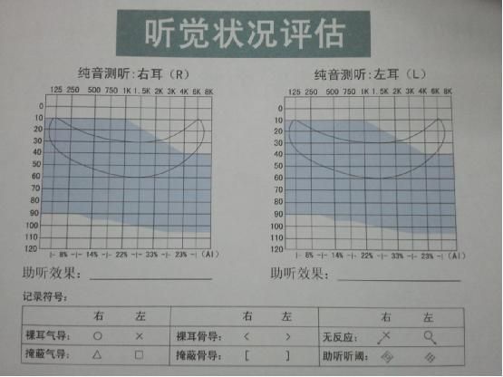 用户如何看懂听力图?--沈阳助听器